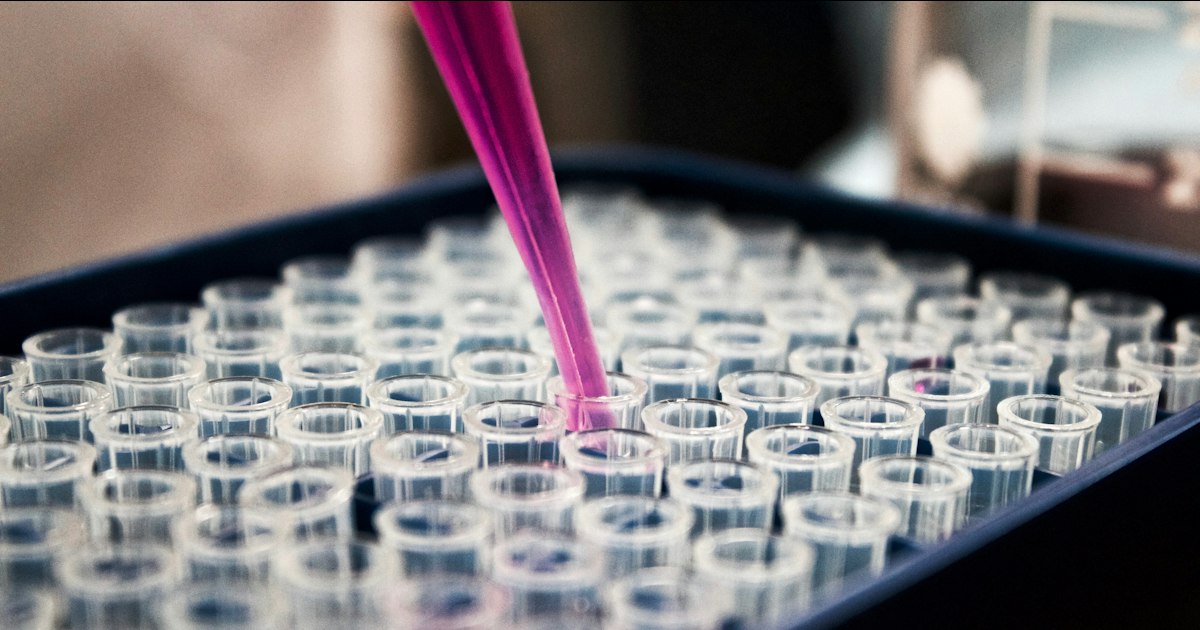 White blood cells above or below normal: causes in athletes and what to do